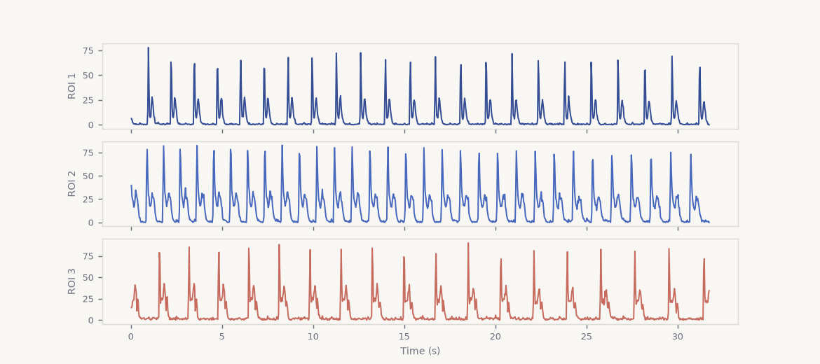 Contractility traces