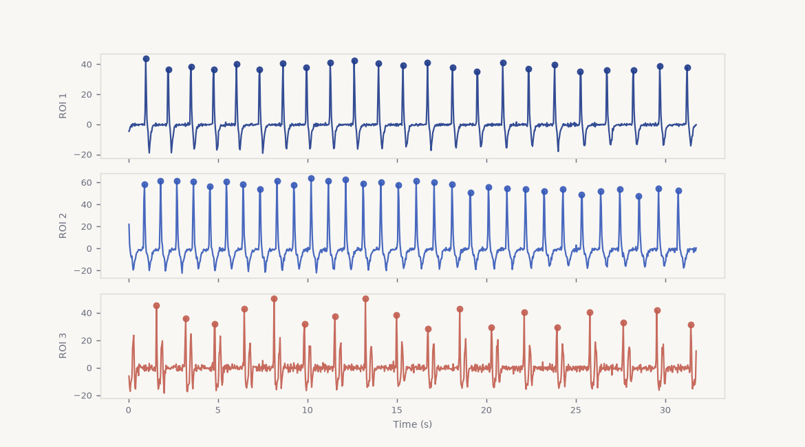 Beat waveforms